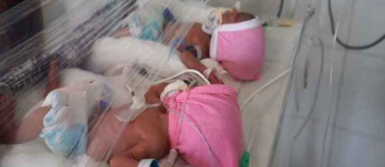 vadodara quadraplets.jpeg vadodara quadraplets.jpeg
