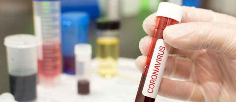 How can a corona test be done, who can test, how much does it cost.jpg How can a corona test be done, who can test, how much does it cost.jpg