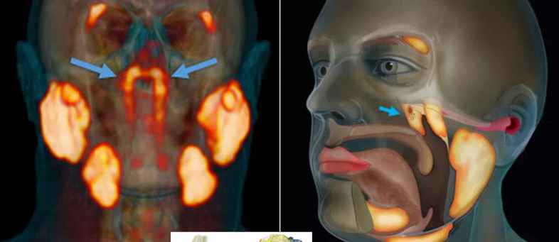 New organ found in human body, these patients will get benefit.jpg New organ found in human body, these patients will get benefit.jpg