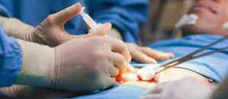 100-fold rise in weight-loss surgeries in 15 years.jpg 100-fold rise in weight-loss surgeries in 15 years.jpg