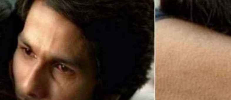 In the film Kabir Singh, Shahid was raised in Rwanda during a scene.jpg In the film Kabir Singh, Shahid was raised in Rwanda during a scene.jpg