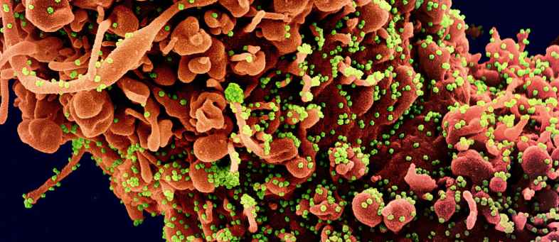 New Zealand Scientists are growing corona virus like plants.jpg New Zealand Scientists are growing corona virus like plants.jpg