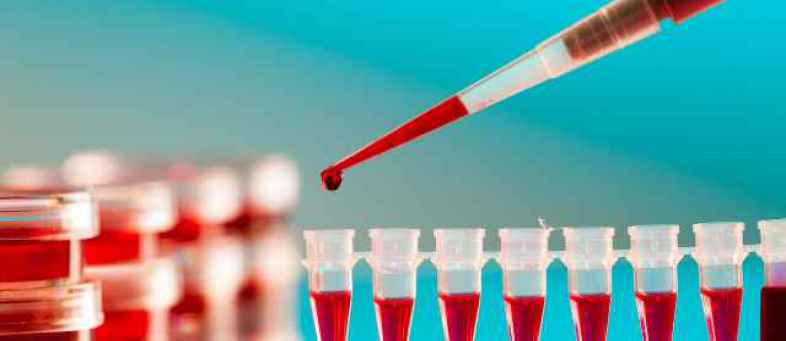 New blood test to trace coronavirus in 20 minutes developed.jpg New blood test to trace coronavirus in 20 minutes developed.jpg