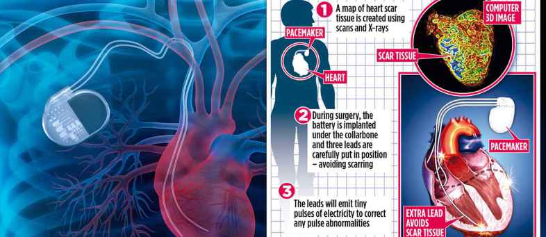 Advanced technology for heart disease is coming in near future.jpg Advanced technology for heart disease is coming in near future.jpg